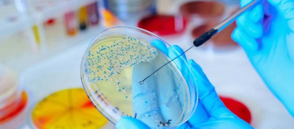 Claire Yeak defends her PHD thesis: “Bacterial stress management – Novel roles of SigB in the Bacillus general stress response”