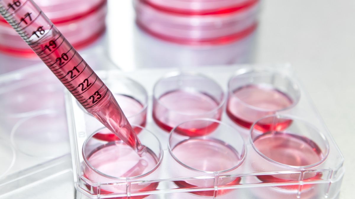 Gene-based strain selection for cheese starter cultures